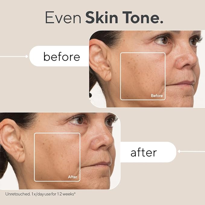 A comparison image showcasing the "before" and "after" effects of using a skincare product for 12 weeks. The top "before" image shows uneven skin tone with visible discoloration, while the bottom "after" image highlights a more even and radiant skin tone. The text emphasizes the result: "Even Skin Tone." A disclaimer notes that the images are unretouched and based on once-daily use for 12 weeks.